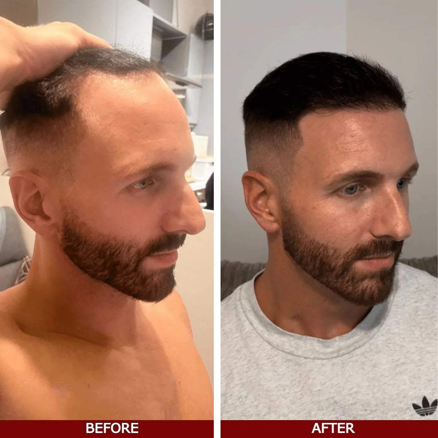 Root revive growth oil